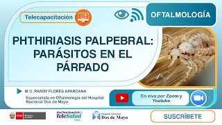 PHTHIRIASIS PALPEBRAL DIAGNÓSTICO Y TRATAMIENTO [upl. by Alrahc357]