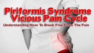 Piriformis Syndrome Causes amp How Pain Increases Via This Vicious Cycle [upl. by Enimaj]