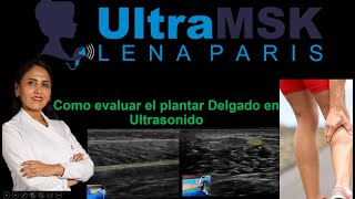 COMO EVALUAR EL TENDÓN Y MÚSCULO PLANTAR DELGADO EN ULTRASONIDO PLANTARIS TENDON [upl. by Ferrigno]