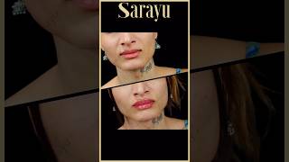 Lip amp Jawline Enhancement Magic  Sarayu Clinics fillers beauty [upl. by Secilu]