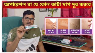 Mederma Advanced Scar Removal Gel  সার্জারির দাগ দ্রুতগতিতে দূর করে যে ক্রিম  Scar Removal Cream [upl. by Enelear]