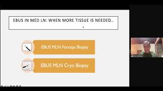 Module 6 EBUS Guided Mediastinal LN Forcep Biopsy amp Cryo Biopsy 8th November [upl. by Adnoryt]