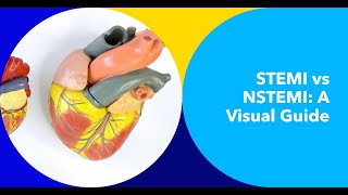 Deciphering STEMI vs NSTEMI on ECG A Comprehensive Visual Guide [upl. by Ytirev]