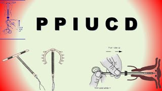 Postpartum Intrauterine Contraceptive Device PPIUCD  Birth Control Device [upl. by Enilesor]