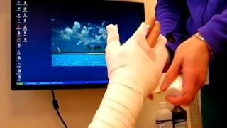 How to Make a Cast for a Hand Fracture  Nicky Leung MD [upl. by Barbette]