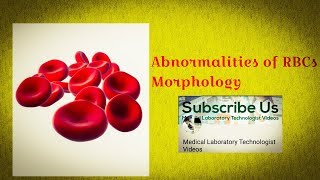 Red blood cells Morphological abnormalities Microscopic images [upl. by Checani]