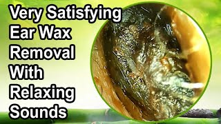 Very Satisfying Video DEEP amp Stony HARD Earwax Removal With Relaxing Sounds [upl. by Furr]