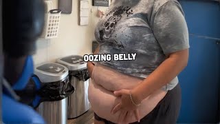 I Have An Apron Belly 😲  STORYTRENDER [upl. by Margarida]