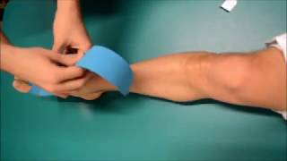 Kinesio Taping per la Periostite del Corridore o Podista [upl. by Lissy]