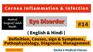 Cornea inflammation and infection  Keratitis  Hindi [upl. by Yolande]