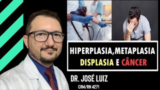 Endoscopia com Pólipo Hiperplásico Adenoma Displasia e Metaplasia indicam câncer [upl. by Hareehat]