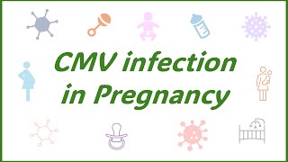 Congenital CMV infection [upl. by Ruvolo]