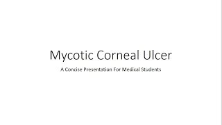 Mycotic Corneal Ulcer  Fungal Keratitis  Ophthalmology For Medical Students [upl. by Sorazal]