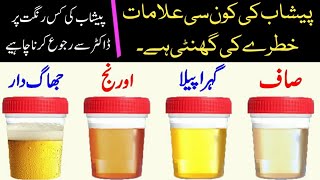 Urine problem  Urine Healthy Color  Peshab Ki Rangat Se Bimari Ki Tashkees  Online Remedies [upl. by Earlie]