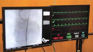 Cardiac Catheterisation Part 1  Left Coronary [upl. by Siuqramed]