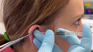 How to do Helix Piercing [upl. by Araht]