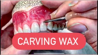 CARVING DENTURES IN WAX WAXBAE DENTURES [upl. by Corwin]