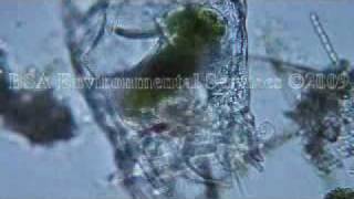 Brachionus patulus feeding Zooplankton Rotifer [upl. by Drofkcor]