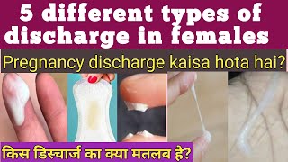 5 types of Discharge in females kis discharg ka kya matlab hota hai pregnancy discharge kaisa hota h [upl. by Rafaelia]