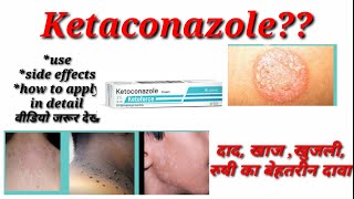 KETOCONAZOLE cream  Lotion usesside effects how to apply [upl. by Akirat]