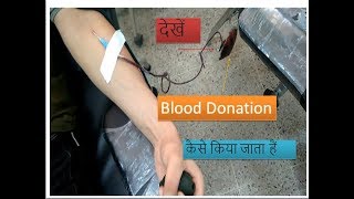 Phlebotomy skills fresh blood collection for blood bank [upl. by Danczyk]