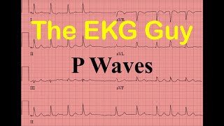 EKGECG P Waves  Question 40 l The EKG Guy [upl. by Ahsaela]