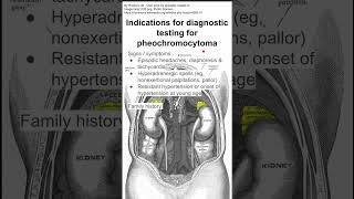 Indications for diagnostic testing for pheochromocytoma [upl. by Laertnom647]