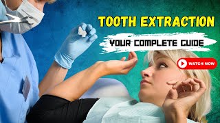 Tooth Extraction Demystified  Your Complete Guide [upl. by Manfred]