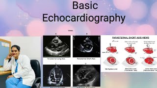 Basic Echocardiography views measurements Details knowledge echo By Babita [upl. by Cassell29]