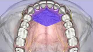 Dr Malamed local anesthesia maxillary injections [upl. by Finzer]