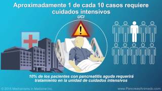 Manejo y tratamiento de la pancreatitis aguda [upl. by Maire]