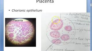 Obstetrics 243 GESTATIONAL TROPHOBLASTIC DISEASES Placental tumor Hydatidiform Mole Choriocarcinoma [upl. by Skippy]