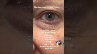 Myokymia healthtips eyecare eyediseases [upl. by Beitnes797]