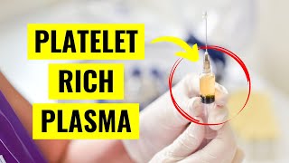 Platelet Rich Plasma PRP Injections Everything You Need to Know [upl. by Omar]