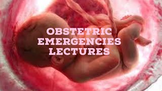 OBSTETRIC EMERGENCIES lecture 1 ANTEPARTUM HEMORRAHGE placental abruption and previa made simple [upl. by Nedla]