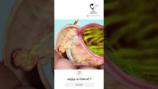 Is betel leaf good for health  உணவிற்குப் பின் வெற்றிலை நல்லதா  DrIsacc Abbas [upl. by Reizarf520]