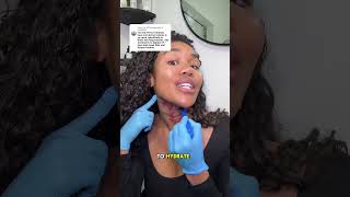 Neck tightening WITHOUT surgery neck looseskin antiagingtreatments [upl. by Tormoria]