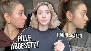 Ich habe die Pille abgesetzt und das ist passiert 1 Jahr später  VLOG [upl. by Nitsid]