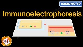 Immunoelectrophoresis FLImmuno59 [upl. by Ettesus103]