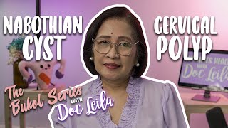 CERVICAL POLYP amp NABOTHIAN CYST THE BUKOL SERIES EP 2 with Doc Leila OBGYNE Philippines [upl. by Marysa]