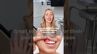 Is gum disease an STD You’d be surprised to know the answer to this question dentist [upl. by Schoenfelder]