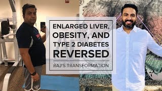 Enlarged Liver Reversal  Type 2 Diabetes Reversal  Obesity Reversal — Rajs Transformation [upl. by Diandre]