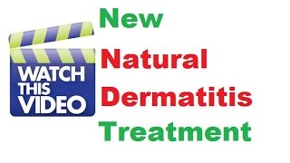 Stasis dermatitis treatment Dermatology doctor Dermatology specialist [upl. by Snashall]