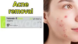 Acne ka ilaj in urdu Betnovate cream uses in urdu by medicine infomaster [upl. by Siuol]