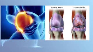 5 Best Prescription Arthritis Creams For Joint Pain [upl. by Eerak]