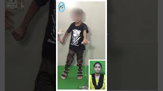 Dyskinetic cerebralpalsy child managed by therapy amp brace at trishla [upl. by Simmons552]