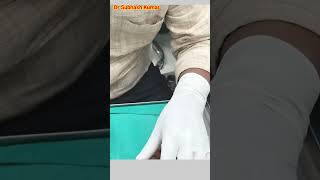 How Lignocaine Is Given Xylocaine कैसे दिया जाता है drsubhashkumar anaesthesia [upl. by Priebe]