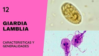 Giardia Lamblia 12  Giardiasis  Parasitología  Flagelados [upl. by Eninnej]