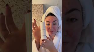 Acne face morning routine [upl. by Atiekram]