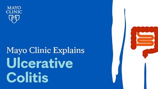 Mayo Clinic Explains Ulcerative Colitis [upl. by Atteuqahc610]